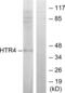 5-Hydroxytryptamine Receptor 4 antibody, abx013888, Abbexa, Western Blot image 