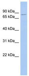 Proprotein Convertase Subtilisin/Kexin Type 1 antibody, TA334299, Origene, Western Blot image 