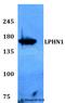 Adhesion G Protein-Coupled Receptor L1 antibody, LS-C411927, Lifespan Biosciences, Western Blot image 