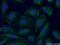 Protein PIEZO1 antibody, 15939-1-AP, Proteintech Group, Immunofluorescence image 