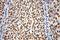 Heterogeneous nuclear ribonucleoprotein D0 antibody, 12770-1-AP, Proteintech Group, Immunohistochemistry paraffin image 