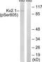 Potassium Voltage-Gated Channel Subfamily B Member 1 antibody, TA314122, Origene, Western Blot image 