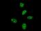 Makorin Ring Finger Protein 3 antibody, MA5-20268, Invitrogen Antibodies, Immunofluorescence image 