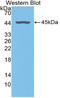 Fibromodulin antibody, LS-C314788, Lifespan Biosciences, Western Blot image 