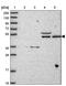 AT-Rich Interaction Domain 3B antibody, PA5-62169, Invitrogen Antibodies, Western Blot image 