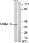 Heterogeneous nuclear ribonucleoprotein G antibody, GTX87416, GeneTex, Western Blot image 