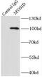 Myosin ID antibody, FNab05505, FineTest, Immunoprecipitation image 