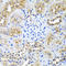 Ninein antibody, A03001, Boster Biological Technology, Immunohistochemistry paraffin image 