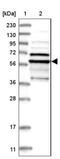 Tubulin Epsilon 1 antibody, NBP1-85204, Novus Biologicals, Western Blot image 