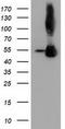Sequestosome 1 antibody, CF502127, Origene, Western Blot image 