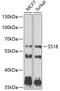 SS18 Subunit Of BAF Chromatin Remodeling Complex antibody, 22-612, ProSci, Western Blot image 