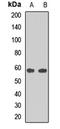 PR/SET Domain 11 antibody, orb412760, Biorbyt, Western Blot image 