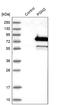 Phosphoglucomutase 2 antibody, HPA040676, Atlas Antibodies, Western Blot image 