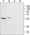 5-Hydroxytryptamine Receptor 3A antibody, TA329058, Origene, Western Blot image 