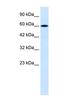 Dachshund Family Transcription Factor 2 antibody, NBP1-80001, Novus Biologicals, Western Blot image 