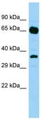 HHIP Like 2 antibody, TA331736, Origene, Western Blot image 