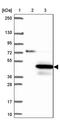 Coiled-Coil Domain Containing 189 antibody, PA5-61206, Invitrogen Antibodies, Western Blot image 