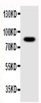 Nlrp4g antibody, PA5-79741, Invitrogen Antibodies, Western Blot image 