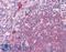 Bruton Tyrosine Kinase antibody, LS-B4855, Lifespan Biosciences, Immunohistochemistry frozen image 
