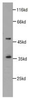 Cyclin Dependent Kinase 6 antibody, FNab01561, FineTest, Western Blot image 