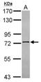 NOP9 Nucleolar Protein antibody, NBP2-15634, Novus Biologicals, Western Blot image 