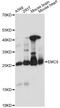 ER Membrane Protein Complex Subunit 8 antibody, A14838, ABclonal Technology, Western Blot image 