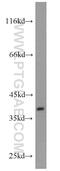 Gonadotropin Releasing Hormone Receptor antibody, 19950-1-AP, Proteintech Group, Western Blot image 