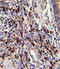 CCR4-NOT transcription complex subunit 8 antibody, A05401-1, Boster Biological Technology, Immunohistochemistry paraffin image 