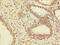 Protein Phosphatase 1 Catalytic Subunit Gamma antibody, CSB-PA018505LA01HU, Cusabio, Immunohistochemistry paraffin image 
