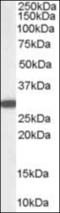 NAD(P)H Quinone Dehydrogenase 1 antibody, orb375512, Biorbyt, Western Blot image 