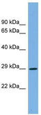 Cyclin Dependent Kinase 1 antibody, TA344356, Origene, Western Blot image 
