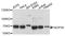 NOP58 Ribonucleoprotein antibody, A4749, ABclonal Technology, Western Blot image 