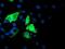 Iduronate 2-Sulfatase antibody, MA5-25855, Invitrogen Antibodies, Immunocytochemistry image 