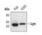 LYN Proto-Oncogene, Src Family Tyrosine Kinase antibody, MA5-14924, Invitrogen Antibodies, Western Blot image 