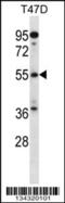 ADP-ribosylation factor GTPase-activating protein 3 antibody, 57-785, ProSci, Western Blot image 