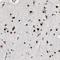 Pogo Transposable Element Derived With ZNF Domain antibody, HPA006800, Atlas Antibodies, Immunohistochemistry frozen image 