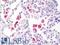 Acid Phosphatase 5, Tartrate Resistant antibody, LS-B10747, Lifespan Biosciences, Immunohistochemistry paraffin image 