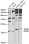Regulator of G-protein signaling 8 antibody, 24-015, ProSci, Western Blot image 