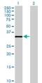 Dehydrogenase/Reductase 7B antibody, H00025979-B01P, Novus Biologicals, Western Blot image 