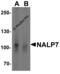 NACHT, LRR and PYD domains-containing protein 7 antibody, 5963, ProSci, Western Blot image 