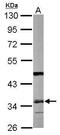 Small Glutamine Rich Tetratricopeptide Repeat Containing Alpha antibody, GTX114755, GeneTex, Western Blot image 
