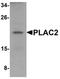 Placenta-specific protein 2 antibody, orb75510, Biorbyt, Western Blot image 