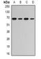RNA Guanylyltransferase And 5'-Phosphatase antibody, orb341079, Biorbyt, Western Blot image 