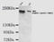 Lysine Demethylase 5C antibody, TA346985, Origene, Western Blot image 