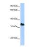 DND MicroRNA-Mediated Repression Inhibitor 1 antibody, NBP1-57258, Novus Biologicals, Western Blot image 