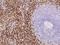 FcRIIIb antibody, 11046-MM21, Sino Biological, Immunohistochemistry paraffin image 