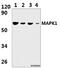 ERK8 antibody, A10088-3, Boster Biological Technology, Western Blot image 