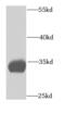 Electron transfer flavoprotein subunit alpha, mitochondrial antibody, FNab02875, FineTest, Western Blot image 