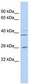 3'(2'), 5'-Bisphosphate Nucleotidase 1 antibody, TA344274, Origene, Western Blot image 