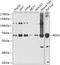 Ribophorin II antibody, GTX32840, GeneTex, Western Blot image 
